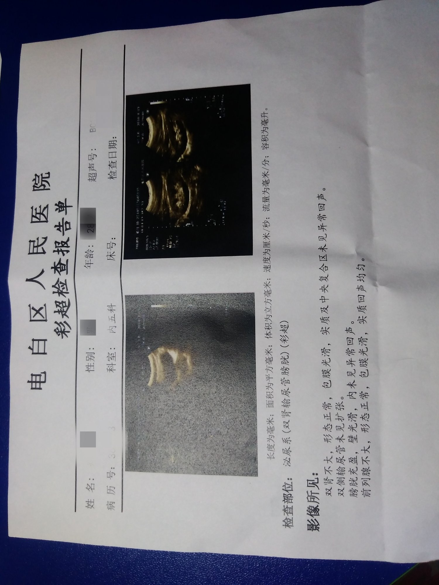 IMG_20180413_103536R_mh1523595797476.jpg IMG_20180413_103536R_mh1523595797476.jpg